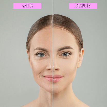 Masajeador Facial de la Piel