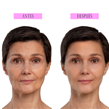 Masajeador Facial de la Piel